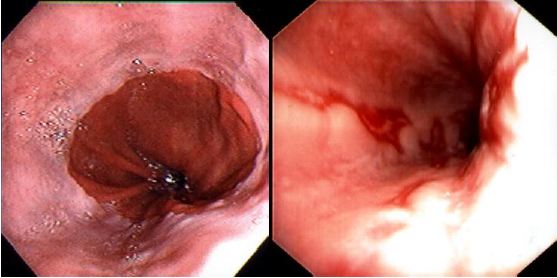 figure3
