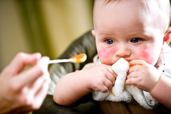Uşaqlarda allergiyaya ən &ccedil;ox səbəb olan qidalar